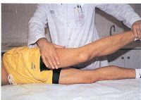 Síndrome de la cintilla iliotibial