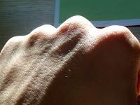 Hace Crujir los Nudillos causa Artritis…Es un MITO