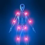 La gestión del dolor de las articulaciones: 1ª parte