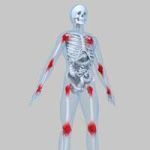 La gestión de dolor de las articulaciones: 2ª parte