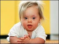 Niños con Síndrome de Down