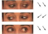 Gimnasia ocular para descansar los ojos