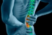 Dolores lumbares (Lumbalgia)