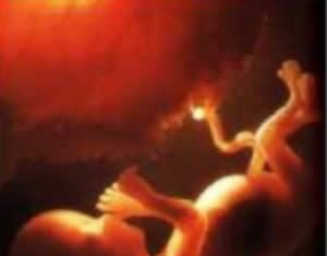 Aborto natural