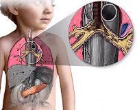 Fibrosis Quística
