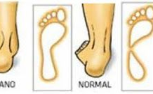Fisioterapia de las Patologías del Pie
