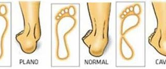 Fisioterapia de las Patologías del Pie