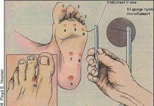 Definición y factores del Pie diabético