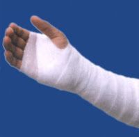 Métodos de la reparación de fractura de huesos