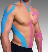 El Kinesiotaping para Acelerar la Recuperación de los Dolores de Espalda
