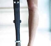 El dolor del miembro fantasma: 1ª parte