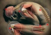 Problemas de reumatología