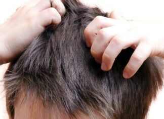 Remedios Naturales Para Combatir La Pediculosis