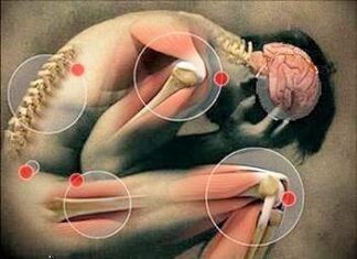 Artrosis: ¿Cuáles son sus Causas, Síntomas y Cómo Prevenirla?