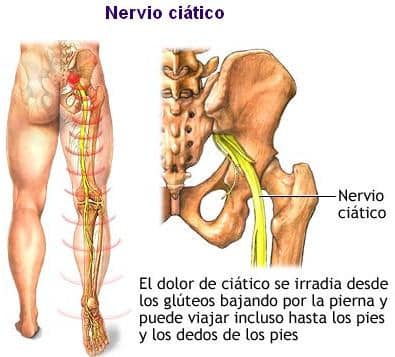 Anatomía del Nervio Ciático