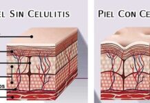 Fisioterapia Estética