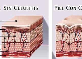 Fisioterapia Estética