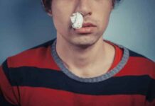 Pacientes con hemofilia y el ejercicio moderado