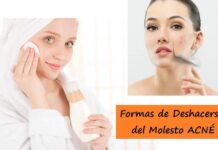Formas de Deshacerse del Molesto ACNÉ Consejos para Tratar y Prevenir el Acné