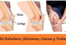 Tendinitis Rotuliana ¡Síntomas, Causas y Tratamiento! Tratamiento de la Tendinitis Rotuliana
