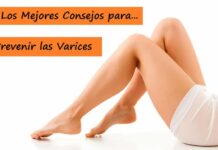 ¿Cómo PREVENIR las VARICES? y Ejercicios para Mejorar la Circulación Consejos para PREVENIR las VARICES