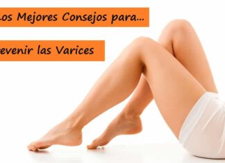 ¿Cómo PREVENIR las VARICES? y Ejercicios para Mejorar la Circulación Consejos para PREVENIR las VARICES