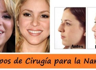 Diferentes Tipos de CIRUGÍAS para la NARIZ Tipos de Cirugía para la Nariz