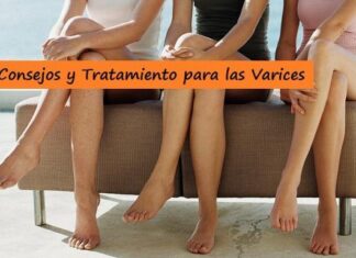 Tratamientos para REDUCIR la Presencia de las VARICES Tratamientos NO Quirúrgicos contra las VARICES