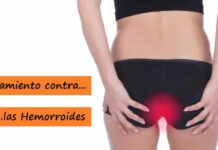 TRATAMIENTOS para Curar las Hemorroides Tratamiento contra las Hemorroides