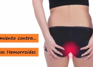 TRATAMIENTOS para Curar las Hemorroides Tratamiento contra las Hemorroides