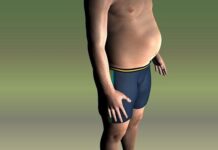 El Sobrepeso Aumenta el Riesgo de Baja Laboral El Sobrepeso Aumenta el Riesgo de Baja Laboral