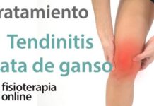 La TENDINITIS de la PATA DE GANSO: ¿Qué es? La TENDINITIS de la PATA DE GANSO
