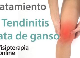 La TENDINITIS de la PATA DE GANSO: ¿Qué es? La TENDINITIS de la PATA DE GANSO