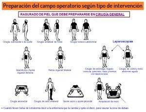 que zonas rasurar antes de una operacion