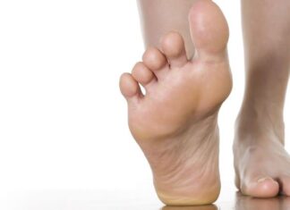 Fascitis plantar fascitis plantar