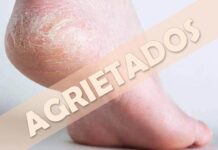 Los pies: ¡los grandes olvidados! Pies agrietados