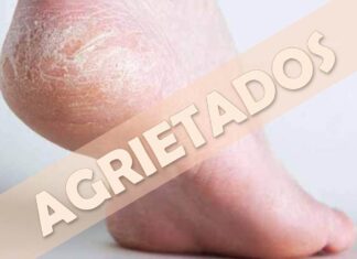 Los pies: ¡los grandes olvidados! Pies agrietados