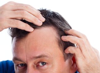 La caída del cabello puede dejar de ser un problema Evita la caida de pelo