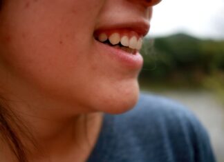 Los mitos sobre el acné Los mitos sobre el acné