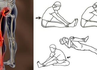 Ejercicios para reducir el dolor de CIÁTICA