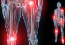 ¿Qué es el dolor articular?