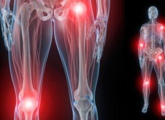 ¿Qué es el dolor articular?
