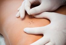 TRATAMIENTOS DE FISIOTERAPIA más utilizados
