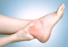 Consejos para el tratamiento de ESGUINCE DE TOBILLO con fisioterapia