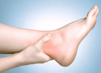 Consejos para el tratamiento de ESGUINCE DE TOBILLO con fisioterapia