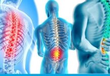 Enfermedades traumatológicas que pueden ser causa de incapacidad permanente Enfermedades traumatológicas que pueden causar incapacidad permanente