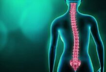 Fisioterapia para tratar la escoliosis