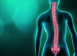 Fisioterapia para tratar la escoliosis