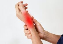 Remedios caseros para la tendinitis