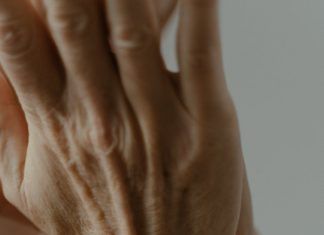 ¿Cómo se trata la artritis?